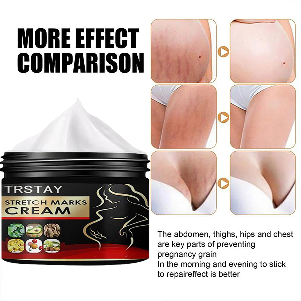 TRSTAY Stretch Mark Cream for Pregnancy Skin Replenish And Repair Cell Growth Promotion Maternity Striae Gravidarum Care