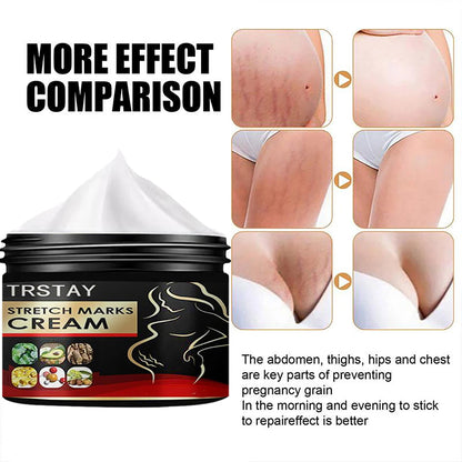 TRSTAY Stretch Mark Cream for Pregnancy Skin Replenish And Repair Cell Growth Promotion Maternity Striae Gravidarum Care