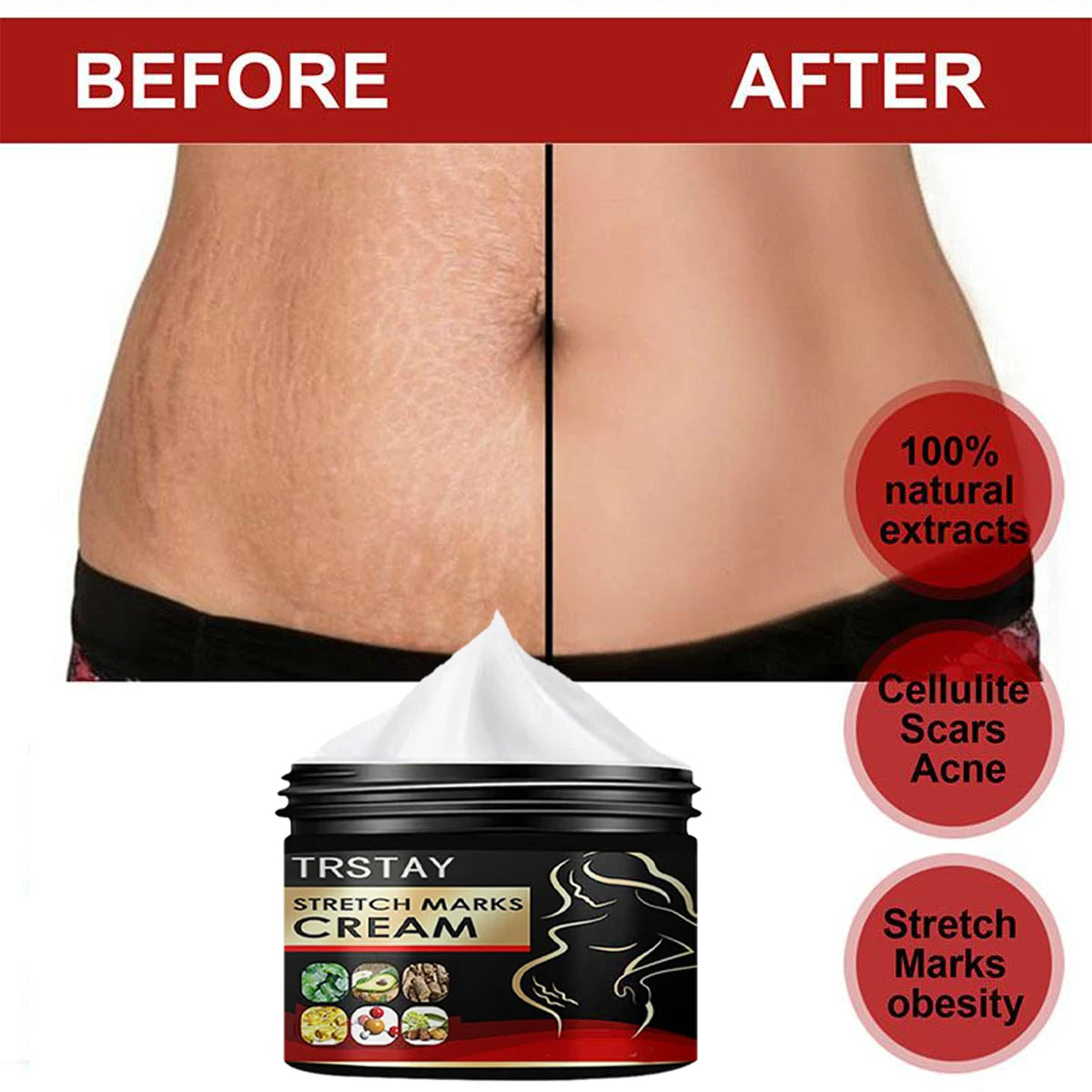 TRSTAY Stretch Mark Cream for Pregnancy Skin Replenish And Repair Cell Growth Promotion Maternity Striae Gravidarum Care