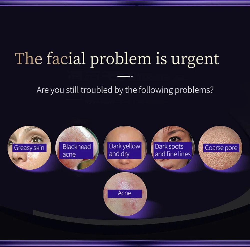 Portable Beauty Device Ems R&f Home Use Face Beauty Purple Facial Beauty Device skin care