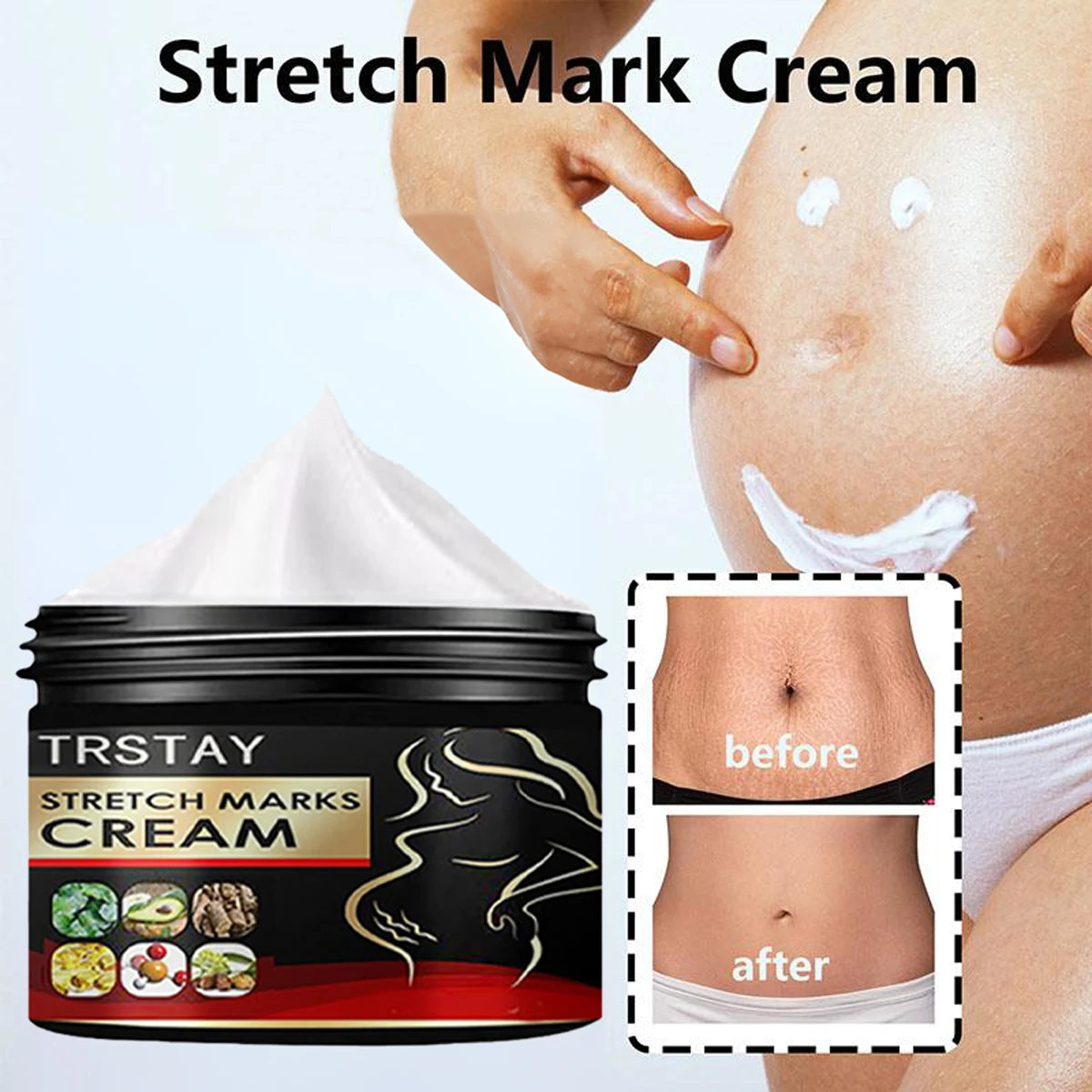 TRSTAY Stretch Mark Cream for Pregnancy Skin Replenish And Repair Cell Growth Promotion Maternity Striae Gravidarum Care