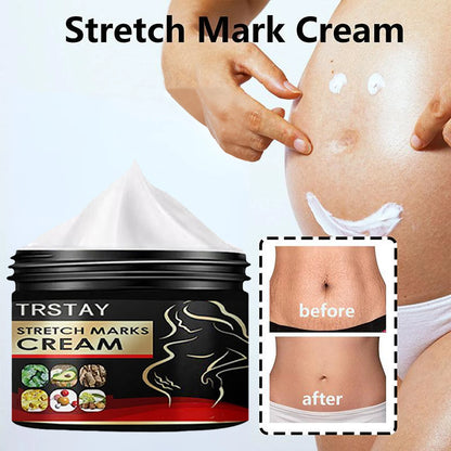 TRSTAY Stretch Mark Cream for Pregnancy Skin Replenish And Repair Cell Growth Promotion Maternity Striae Gravidarum Care