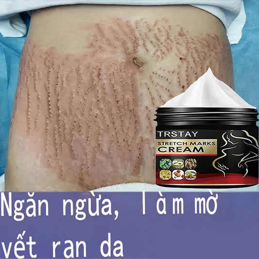 TRSTAY Stretch Mark Cream for Pregnancy Skin Replenish And Repair Cell Growth Promotion Maternity Striae Gravidarum Care