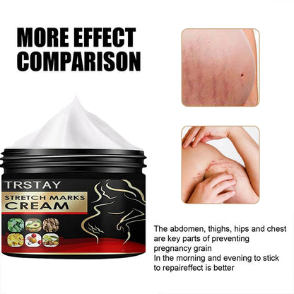 TRSTAY Stretch Mark Cream for Pregnancy Skin Replenish And Repair Cell Growth Promotion Maternity Striae Gravidarum Care