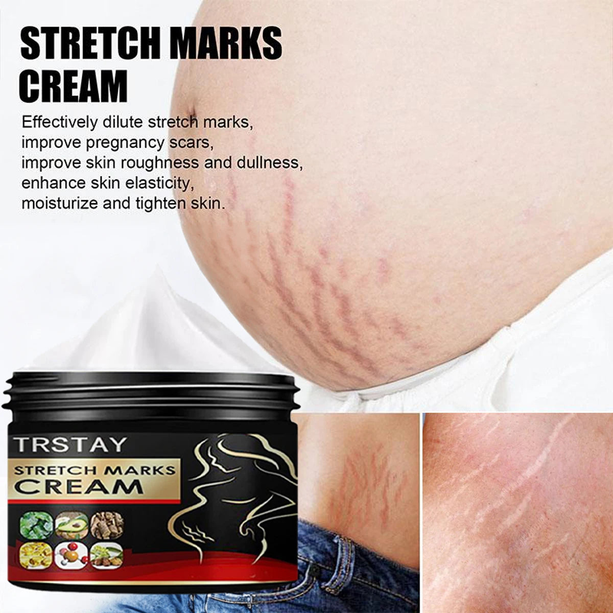 TRSTAY Stretch Mark Cream for Pregnancy Skin Replenish And Repair Cell Growth Promotion Maternity Striae Gravidarum Care